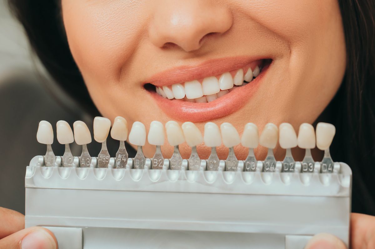 Teeth Whitening
